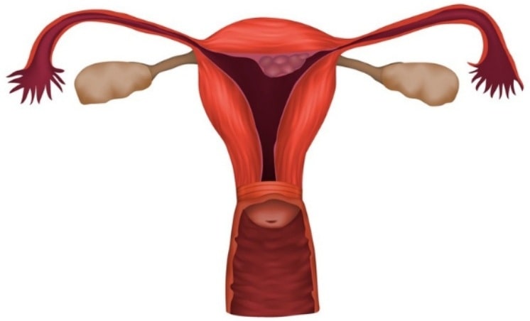 Effective Remedies for Fibroids